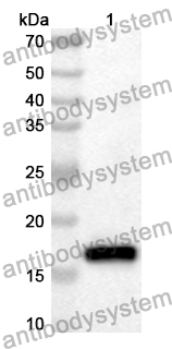 Anti-Human NSD3/WHSC1L1 Polyclonal Antibody