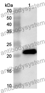 Anti-Human CD32/FcRII/Ly-17 Polyclonal Antibody