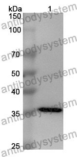 Anti-Human SLC5A8 Polyclonal Antibody