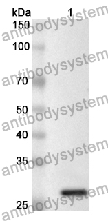 Anti-Human PIEZO1 Polyclonal Antibody