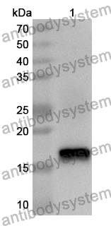 Anti-Human SRCAP Polyclonal Antibody