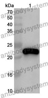 Anti-Human RPP25 Polyclonal Antibody