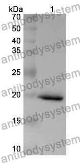 Anti-Human ADAT3 Polyclonal Antibody