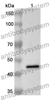 Anti-Human TMPRSS11E/DESC1 Polyclonal Antibody