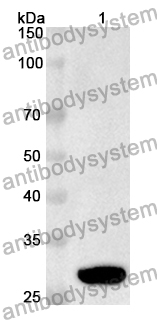 Anti-Human EGLN2/EIT6 Polyclonal Antibody