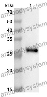 Anti-Human TRIM33 Polyclonal Antibody