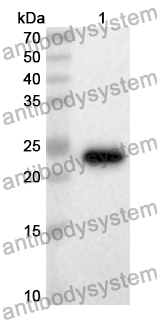 Anti-Human SIX2 Polyclonal Antibody