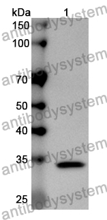 Anti-Human CDKN2A Polyclonal Antibody