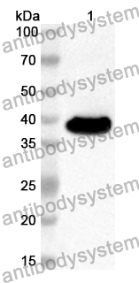 Anti-Human DGCR8 Polyclonal Antibody