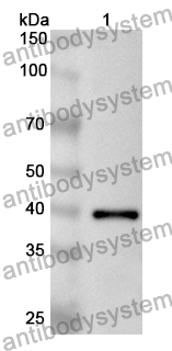 Anti-Human OPTN Polyclonal Antibody