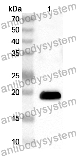 Anti-Human RB1CC1 Polyclonal Antibody