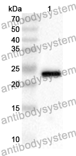 Anti-Human PALLD Polyclonal Antibody