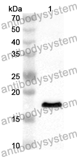 Anti-Human IFT20 Polyclonal Antibody