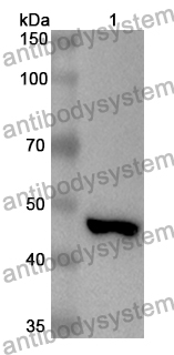 Anti-Human IFT140 Polyclonal Antibody