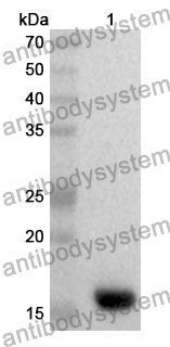 Anti-Human GABARAPL1 Polyclonal Antibody