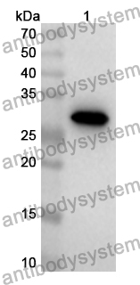 Anti-Human CNOT1 Polyclonal Antibody