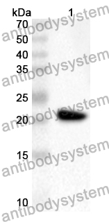 Anti-Human GORASP2 Polyclonal Antibody