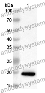 Anti-Human STOML2 Polyclonal Antibody