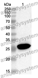 Anti-Human TRIM63 Polyclonal Antibody