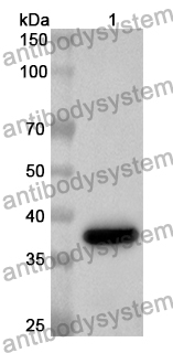 Anti-Human DCAF1 Polyclonal Antibody