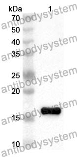 Anti-Human IFT81 Polyclonal Antibody