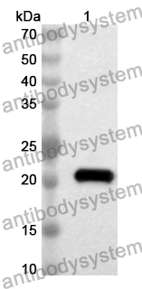 Anti-Human HEY2 Polyclonal Antibody