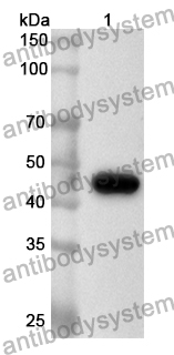 Anti-Human KDM3A Polyclonal Antibody