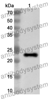 Anti-Human NDE1 Polyclonal Antibody