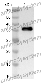 Anti-Human GBP5 Polyclonal Antibody