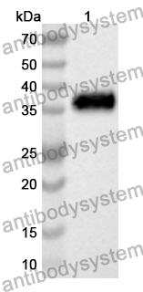 Anti-Human MAT2B Polyclonal Antibody