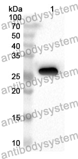 Anti-Human FERMT2 Polyclonal Antibody