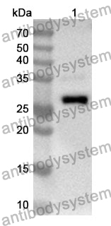 Anti-Human BLOC1S6 Polyclonal Antibody