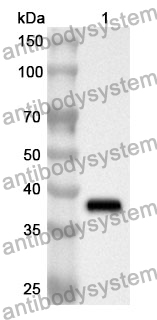 Anti-Human EXOC2 Polyclonal Antibody