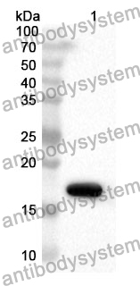 Anti-Human KMT5A Polyclonal Antibody