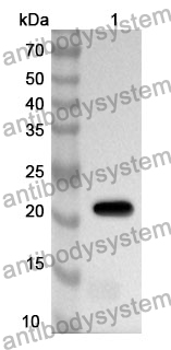 Anti-Human ATOH1 Polyclonal Antibody