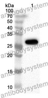 Anti-Human SLC4A4 Polyclonal Antibody