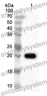 Anti-Human TRIM44 Polyclonal Antibody