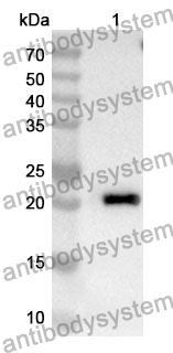 Anti-Human STEAP4 Polyclonal Antibody