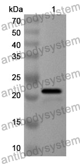 Anti-Human TNFAIP8L2 Polyclonal Antibody