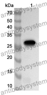 Anti-Human ZC3HAV1 Polyclonal Antibody