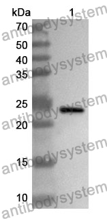 Anti-Human MKS1 Polyclonal Antibody