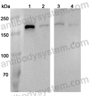 Anti-Human RPTOR Polyclonal Antibody