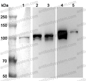 Anti-Human RBM15 Polyclonal Antibody