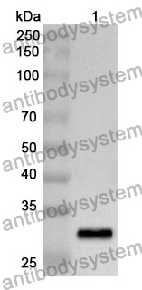 Anti-Human RPGRIP1L Polyclonal Antibody