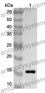 Anti-Human TUT4 Polyclonal Antibody