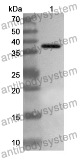 Anti-Human SEPTIN9 Polyclonal Antibody