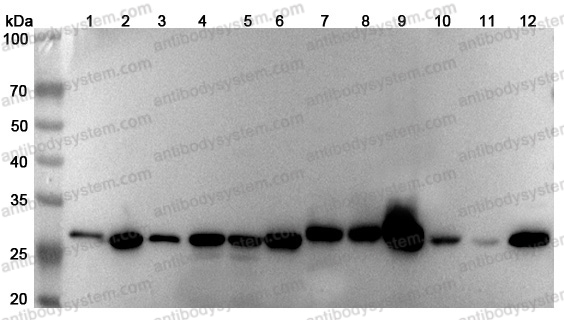 Anti-Human CHCHD3 Polyclonal Antibody