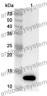 Anti-Human TRDV2 Polyclonal Antibody