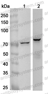 Anti-Human IGF2BP1 Polyclonal Antibody