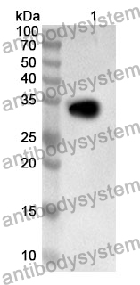 Anti-Human PPP1R15B Polyclonal Antibody